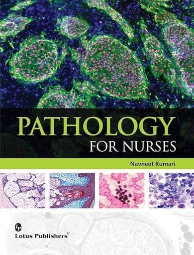 Pathology for Nurses by Navneet Kumari (Lotus Publishers)