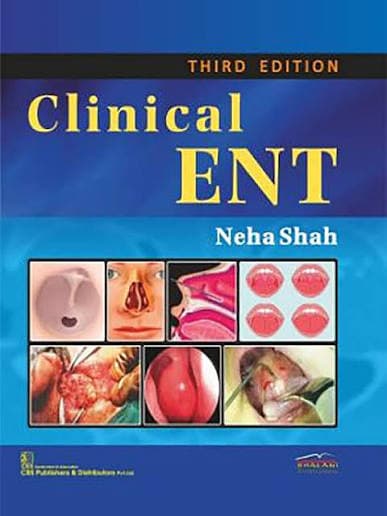 Dr. Neha Shah's Clinical ENT, Third Edition (CBS Publishers & Distributors)